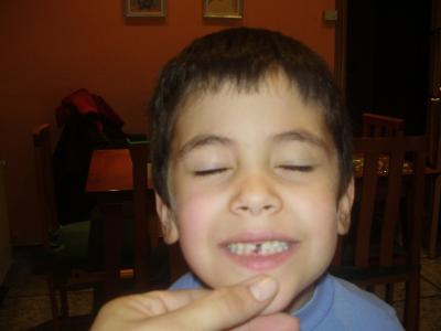 TENGO UN DIENTE MENOS